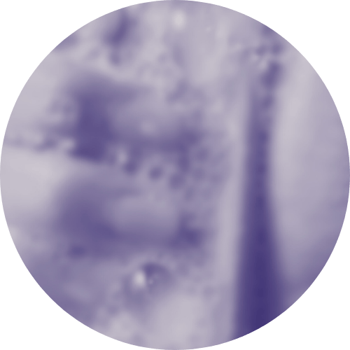 Obsessive Compulsive Therapy